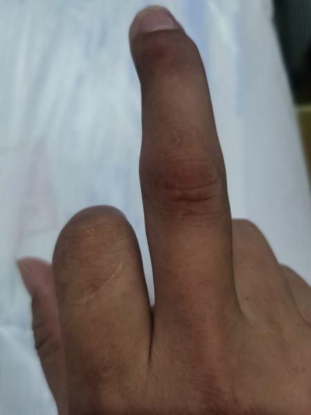 报了工伤,前两天拿到鉴定结果为十级伤残